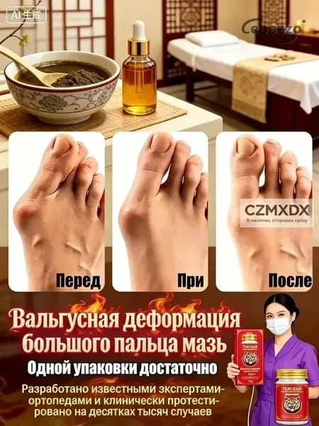 Крем при вальгусной деформации, от шишек на больших пальцах ног,55 мл/Быстродействующие обезболивающие