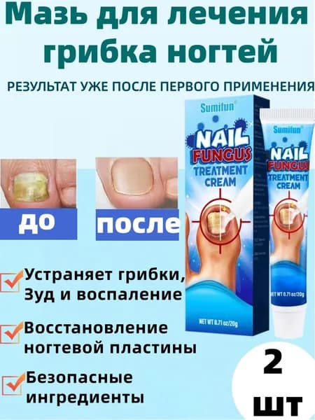 2 шт,Средство от грибка ногтей на ногах; Противогрибковая мазь на основе натуральных компонентов