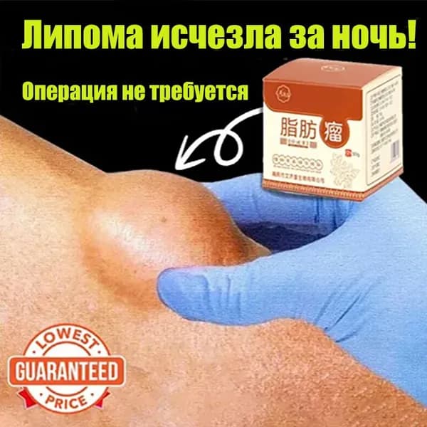 Крем для удаления подкожных припухлостей щитовидная железа липомы 30 г,показан при отечности кожи,целлюлите,фиброзном жировике