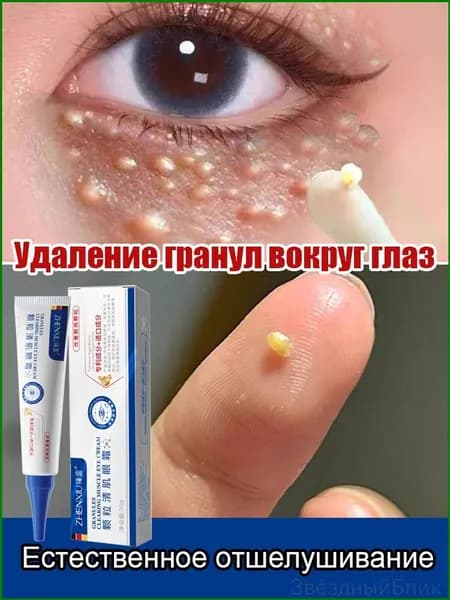 Анти-жировиковый крем для век, устраняет жировики, разглаживает кожу, 30 г
