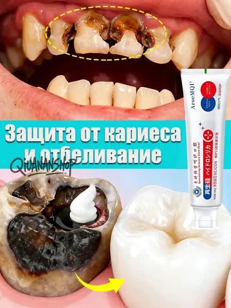 Зубная паста для дырки в зубе, глубокого кариеса и пульпита, Снимает боль, восстанавливает при поражении кариесом у взрослых, Свежее дыхание, 100 г, 1 шт.