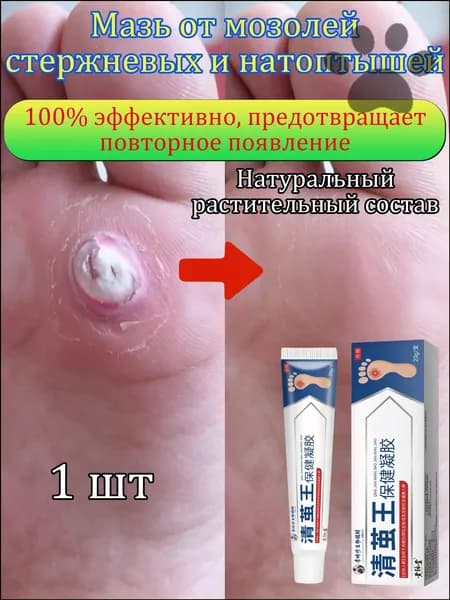 Mазь от мозолей стержневых и натоптышей ,Крем от сухих мозолей, шипицы, бородавок, натоптышей,20 г 1 шт. SYQ-06