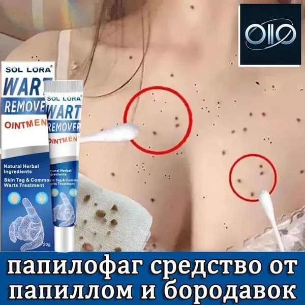 Эксклюзивный состав против папиллом, кондилом, мозолей и наростов на коже, 20 г