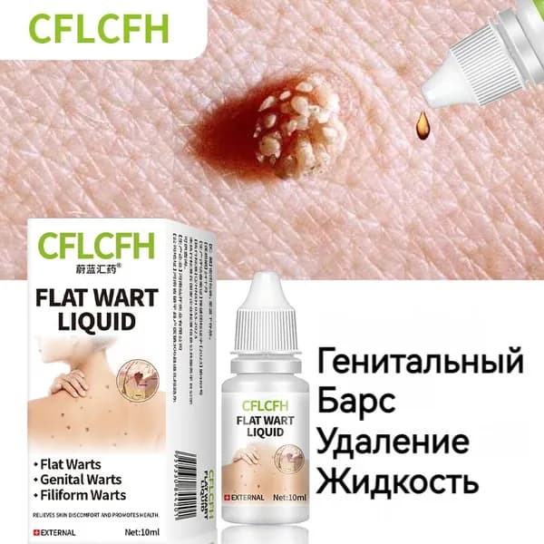 Капли для удаления бородавок,использовать для убирать папилломы, Остроконечные кондиломы, безболезненна, 10 мл,Травяной экстракт