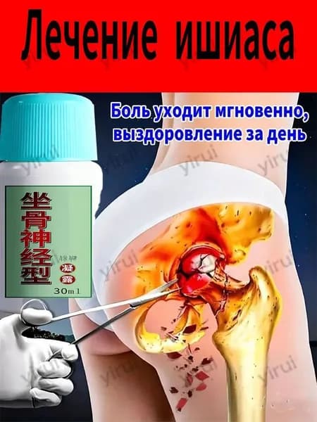 Гель от ишиаса, 30 мл флакон с роликовым аппликатором для облегчения боли и онемения в спине, ягодицах и ногах, 1 шт.