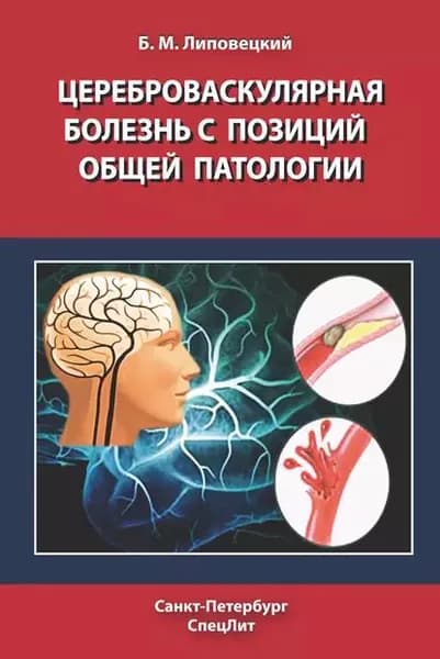 Цереброваскулярная болезнь с позиций общей патологии | Липовецкий Борис Маркович | Электронная книга