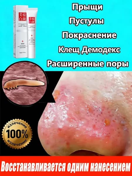 Крем от купероза и покраснений на лице,антикупероз,средство от сосудистых звездочек, от покраснений, розацеа, Китайская чудо-мазь.20 г