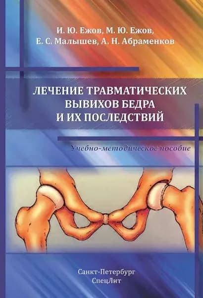 Лечение травматических вывихов бедра и их последствий | Малышев Евгений Степанович, Ежов Игорь Юрьевич | Электронная книга