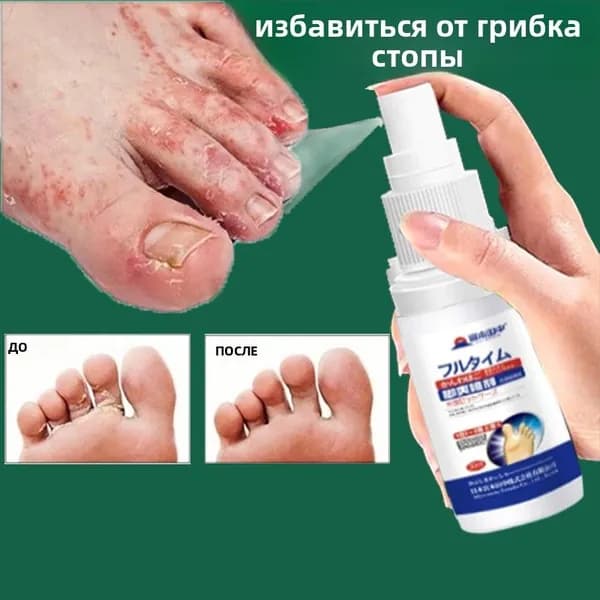 Japan Foot Spray 30мл Щекотка для ног пилинг beriberi дезодорант противогрибковая процедура для ног