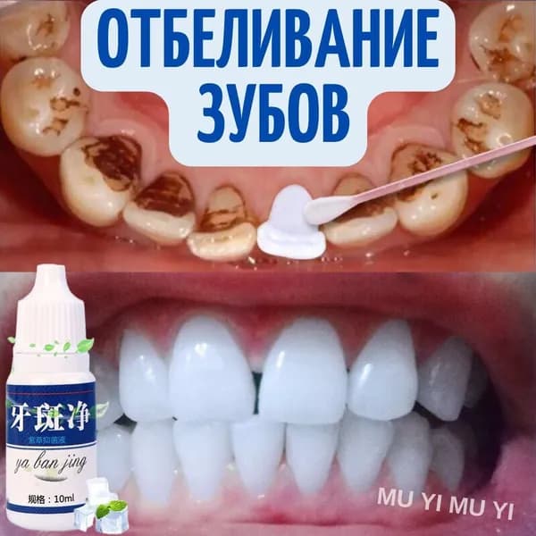 Средство для отбеливания зубов, осветляющая эссенция на основе окопника и магнолии, 5 мл