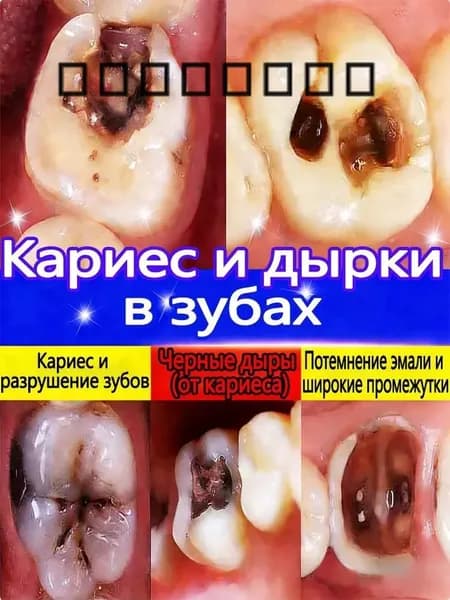 3 в 1: Заделывает дырки, лечит кариес, восстанавливает эмаль. Глубокое восстановление и защита.