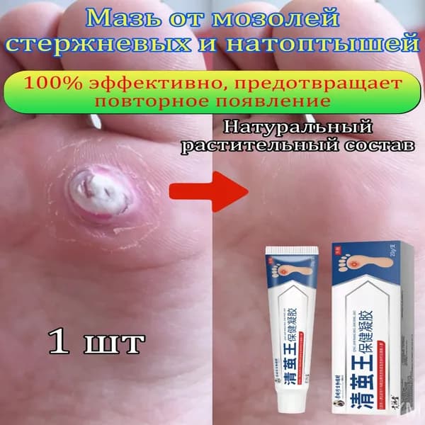 Mазь от мозолей стержневых и натоптышей ,Крем от сухих мозолей, шипицы, бородавок, натоптышей,20 г 1 шт.