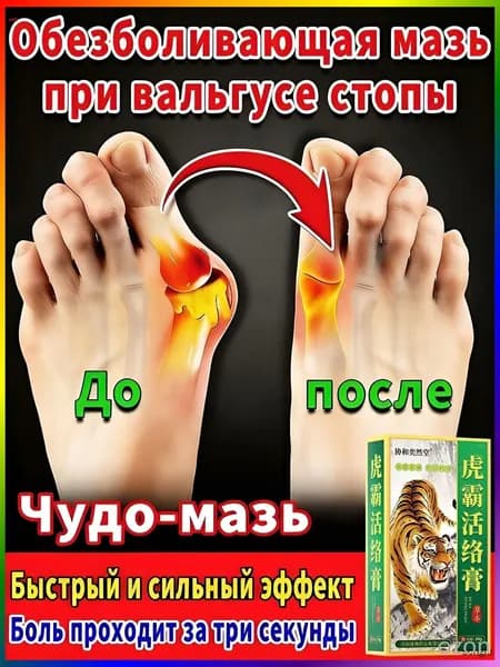 мазь от косточки на большом пальце, от шишек на больших пальцах ног