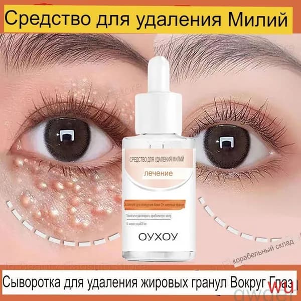 Сыворотка для удаления жировых частиц вокруг глаз, восстанавливающее средство для век "просо", подтяжка морщин, увлажнение и борьба с отечностью, корейский уход за кожей