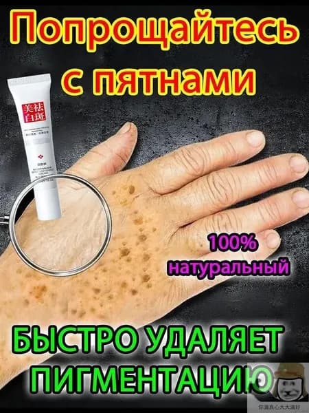 Отбеливающий крем от веснушек и солнечных пятен, подходит для удаления и исчезновения желтых пятен и старчес