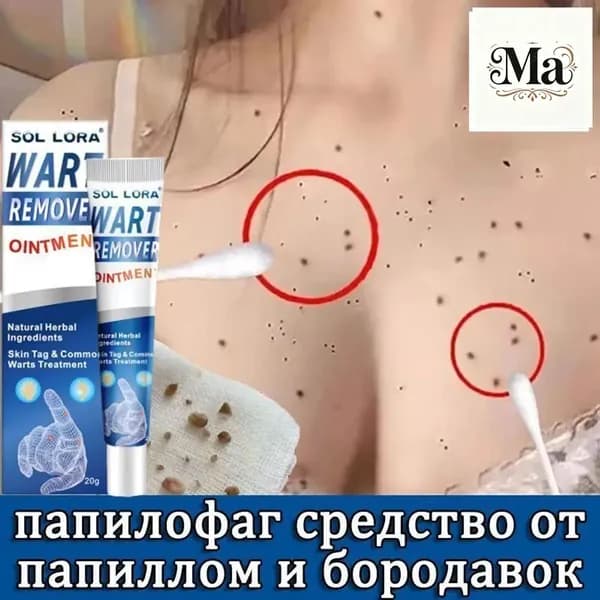 Эксклюзивное средство против кондилом, папиллом, ороговевшей кожи и новообразований, масса 20 г