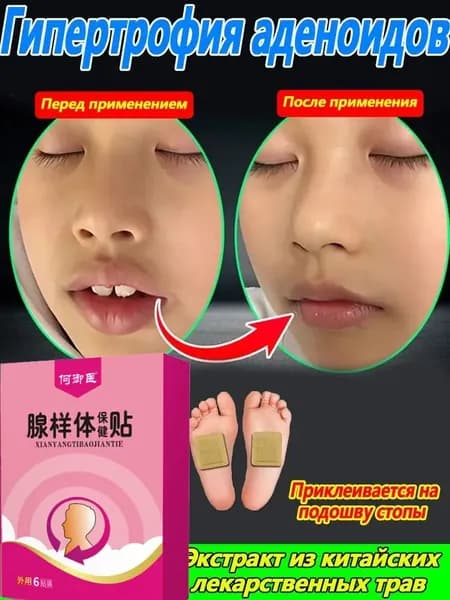 Пластырь традиционной китайской медицины от гипертрофии аденоидов Xiuyishu для коррекции детского лица, 1 коробка