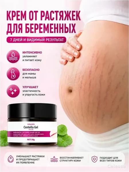 крем от растяжек для беременных,От целлюлита и растяжек, для восстановления упругости кожи,восстанавливает кожу,30 мл