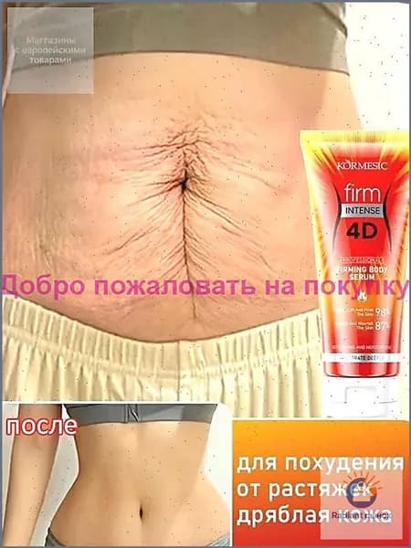 Эксклюзивный антицеллюлитный крем для моделирования тела, коррекции растяжек и упругости кожи