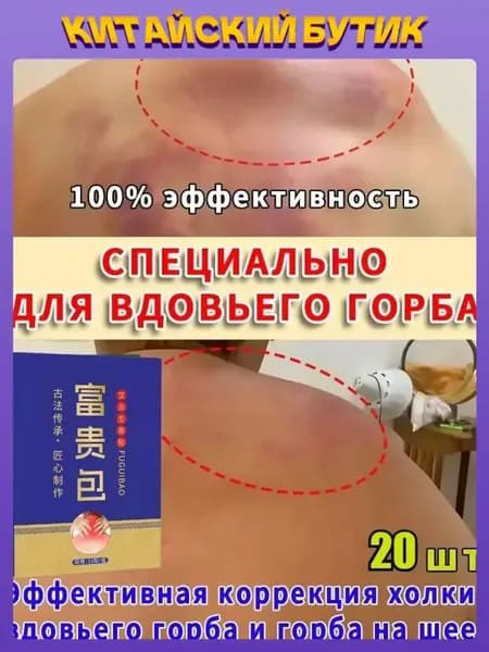 Пластыри для ухода за шеей: от холки, горба и жировых образований. Набор 2 уп. х 10 шт. Снятие дискомфорта, поддержка мышц. Выгодный курс для здоровья спины.