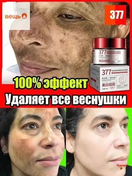377 Отбеливающий крем от веснушек, пигментных пятен, 30 гр, эффективно борется со стойкими темными пятнами, осветляющий