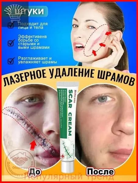 Крем от шрамов и рубцов, гель от прыщей на лице, мазь против ожогов и пигментных пятен и теле, средство от постакне30 г