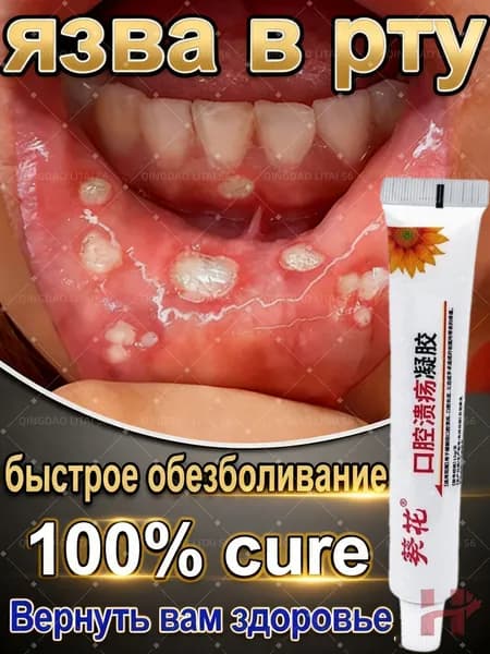 Заживляющий гель для слизистой рта, 10 мл, от стоматита и афт, противовоспалительный, обезболивающий, бактериц