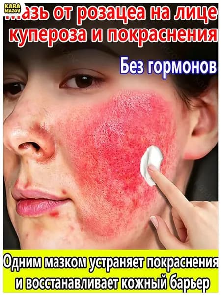 Качественный восстанавливающий крем от покраснений, купероза и розацеа, 20 г, предназначенный для чувствительной кожи лица, используется для увлажнения и успокоения.- karamazov