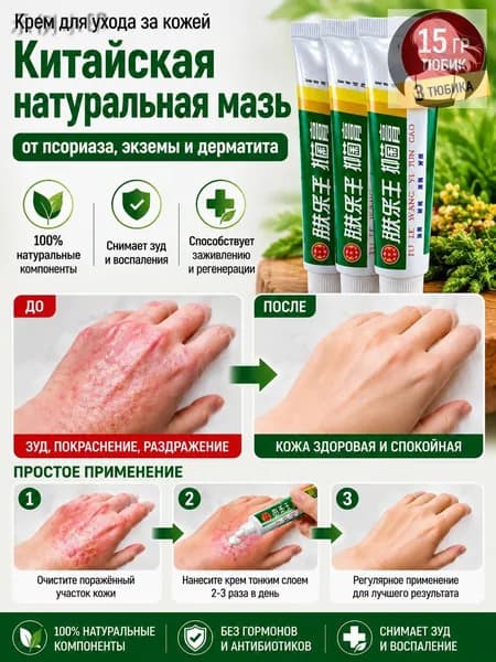 Натуральная китайская мазь от псориаза, экземы и дерматита, быстрое снятие зуда и воспаления, 3 шт
