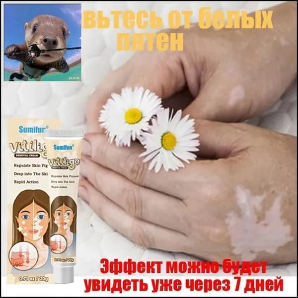 Мазь от витилиго, удаляющая ненужную белую пигментацию, устраняющая белые пятна, крем для ежедневного лечения и ухода