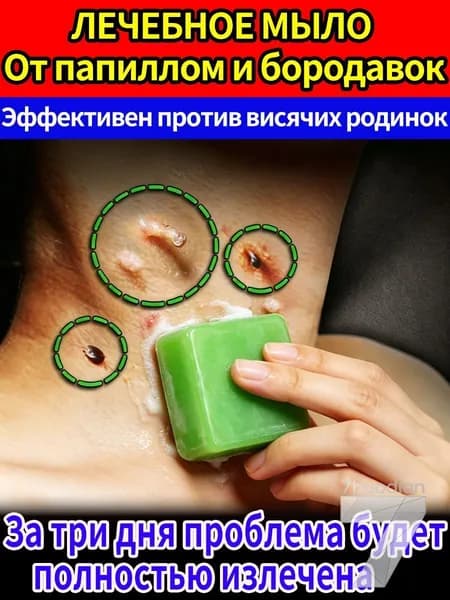 Лечебное мыло от папиллом и бородавок на теле натуральное безболезненное удаление быстрый результат
