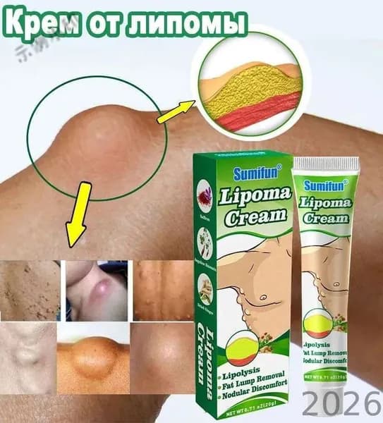 Мазь от липом 20г, рассасывает подкожные уплотнения, уменьшает размеры новообразований, для мужчин и женщин п