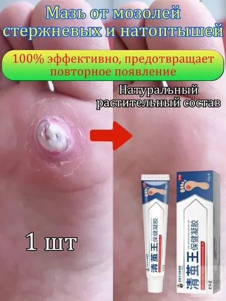 Mазь от мозолей стержневых и натоптышей ,Крем от сухих мозолей, шипицы, бородавок, натоптышей,20 г 1 шт.