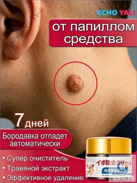 ECHO YALI / Мазь для удаления бородавок, папиллом и новообразований, быстрая и безболезненная, без каких-либо побо Самый продаваемый