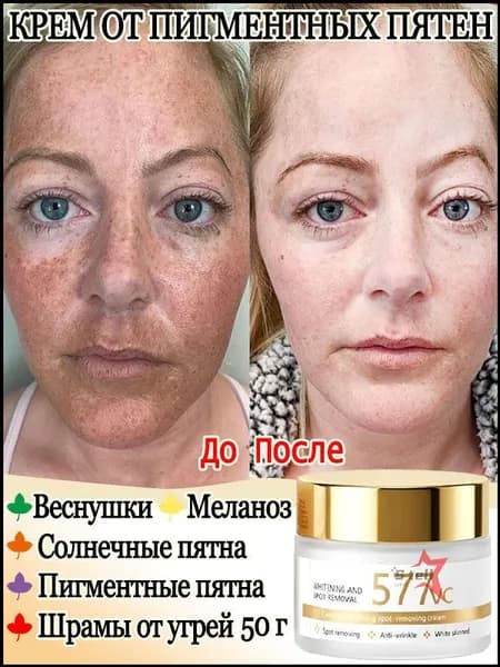 Крем для лица от пигментации с витамином C, эффективно удаляет меланин, смягчает хлоазмы и различные пигментные пятна, осветляет тон кожи, 50 г