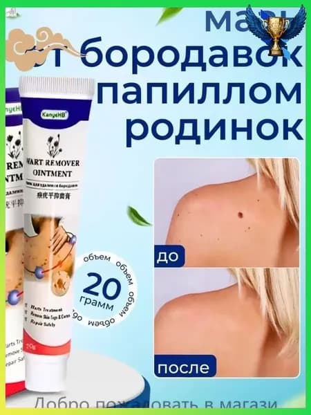 Мазь для удаления бородавок, папиллом и родинок.