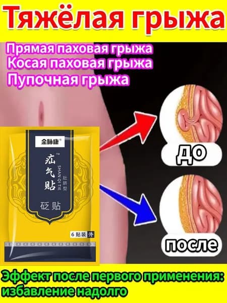 Пластырь от симптомов паховой грыжи: боль и тяжесть внизу живота