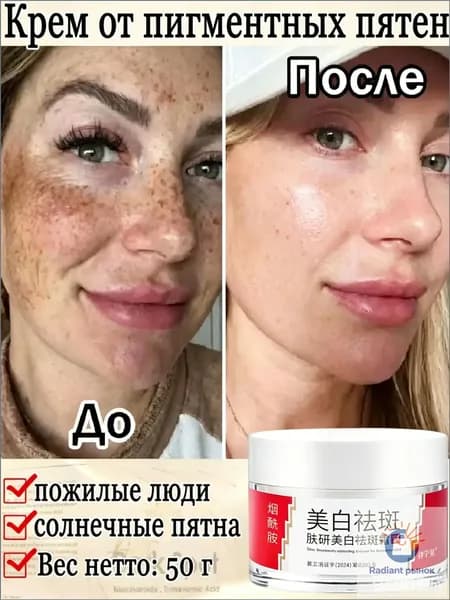 Крем от пигментных пятен на лице,Эффективно удаляет меланин, смягчает хлоазмы и различные пигментные пятна, осветляет тон кожи,50 г