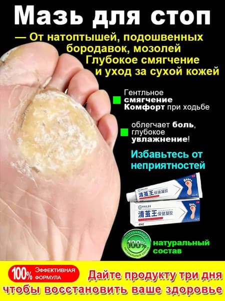 Натуральная мазь из Китая от мозолей и натоптышей на ногах, гель для пяток от натирания, трещин, бородавок разгладьте огрубевшую кожу на мозолистом теле, 20 г