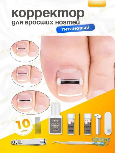 Набор инструментов , комплект корректоров для лечения вросших ногтей на ногах