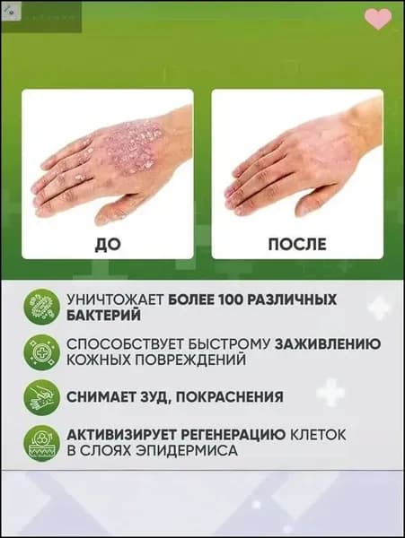 Крем от псориаза на руках 20г Sumifun Psoriasis Cream