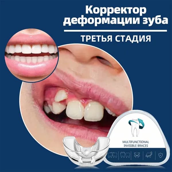 Фаза 3 - Жесткая трейнеров для зубов,для постепенной коррекции и исправления прикуса, выравнивания,от храпа и бруксизма