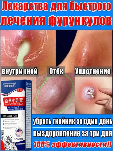 Вытягивающая мазь от фурункулов, чирей, акне и гнойников как Вишневского 20г