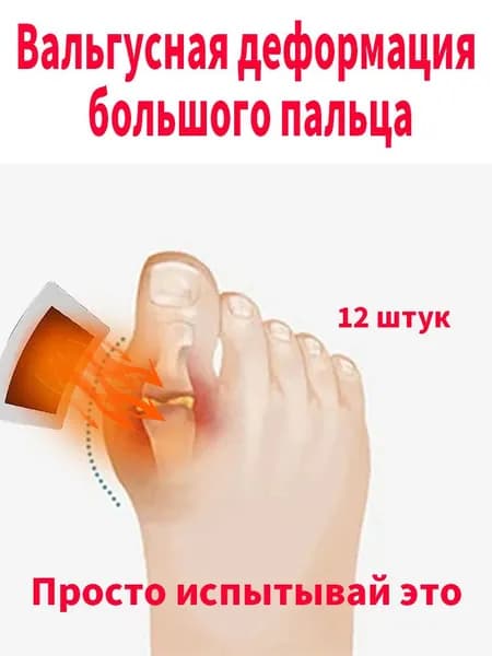 пластырь от косточки на большом пальце Облегчите боль в ногах и улучшите выпячивание суставов