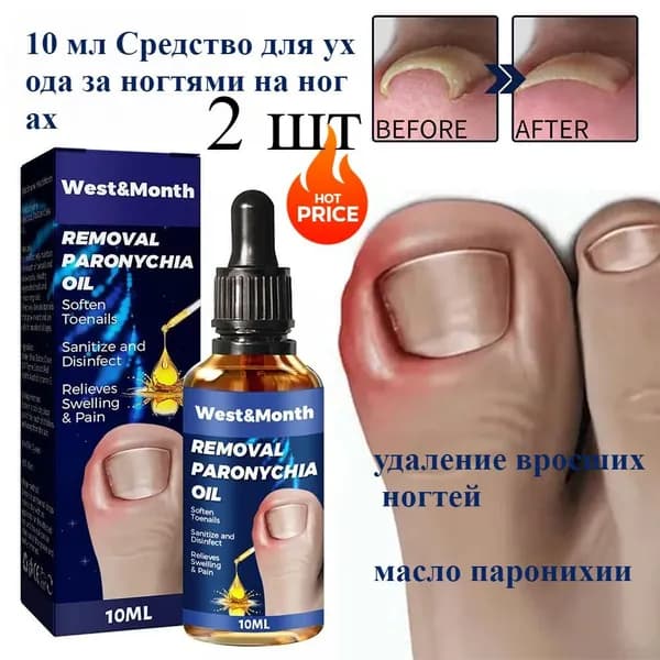 20г Вросшие ногти на ногах, удаляется масло паронихии, для ухода за ногтями на ногах
