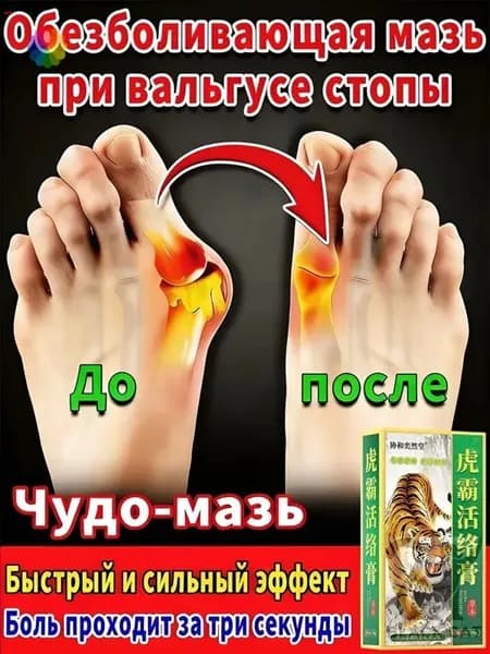 мазь от косточки на большом пальце, от шишек на больших пальцах ног