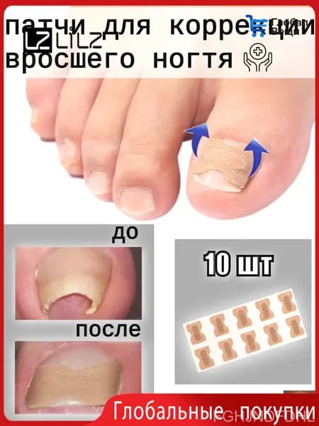 Пластыри для коррекции вросших ногтей на пальцах ног, 10 штук-LZ