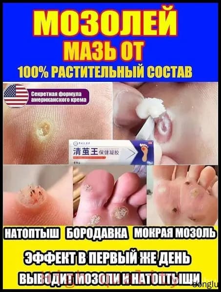 Крем-пилинг для ног от сухих мозолей и натоптышей, 20 г