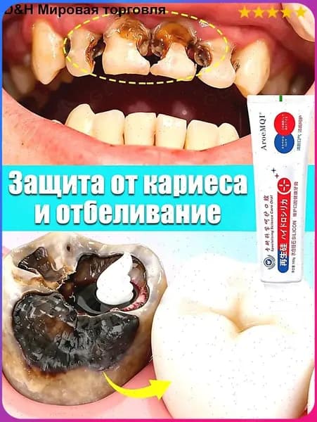 Эксклюзивная зубная паста, предназначенная для терапии пульпита и глубокого кариеса, снимающая боль при поражении зубных тканей, возвращающая свежесть дыханию, 100 г, 1 штука
