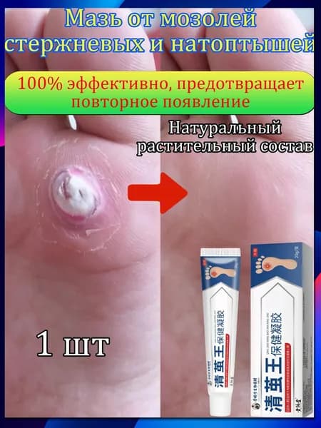 Mазь от мозолей стержневых и натоптышей ,Крем от сухих мозолей, шипицы, бородавок, натоптышей,20 г 1 шт.